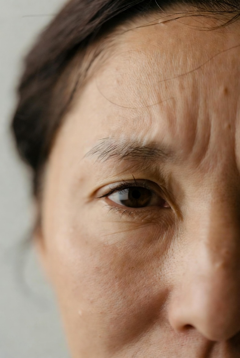 modalități de a combate ridurile